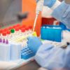 ​Українські медики та науковці вироблятимуть до 7 тисяч ПЛР-тестів кожного дня