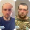 ​Підозрюються двоє учасників окупаційних військ, які підтримували вогнем російських штурмовиків