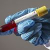 ​На Буковині у трьох священників виявлено коронавірус