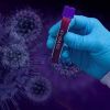 ​СOVID-19: науковці визначили, який показник вказує на тяжку форму