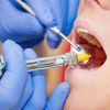 ​Сучасні анестетики в стоматології