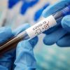 ​Різке зниження кількості хворих на COVID-19 у Запоріжжі