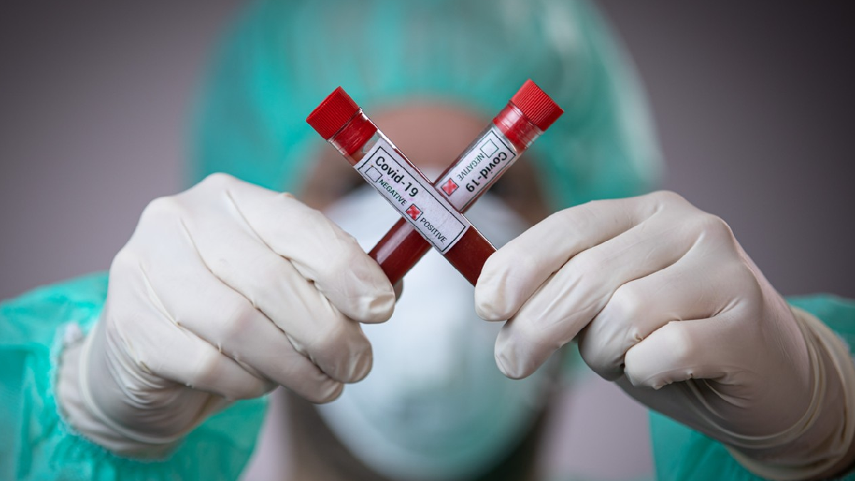 ​Covid-19 дістався до психоневрологічного інтернату що на Житомирщині