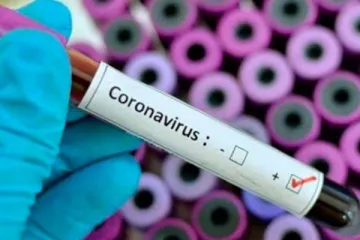 ​ 			 	  	Сегодня зафиксировали 11-тую смерть от коронавируса в Украине - Минздрав 	  	 	  