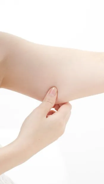 ​Брахиопластика (подтяжка кожи рук)
