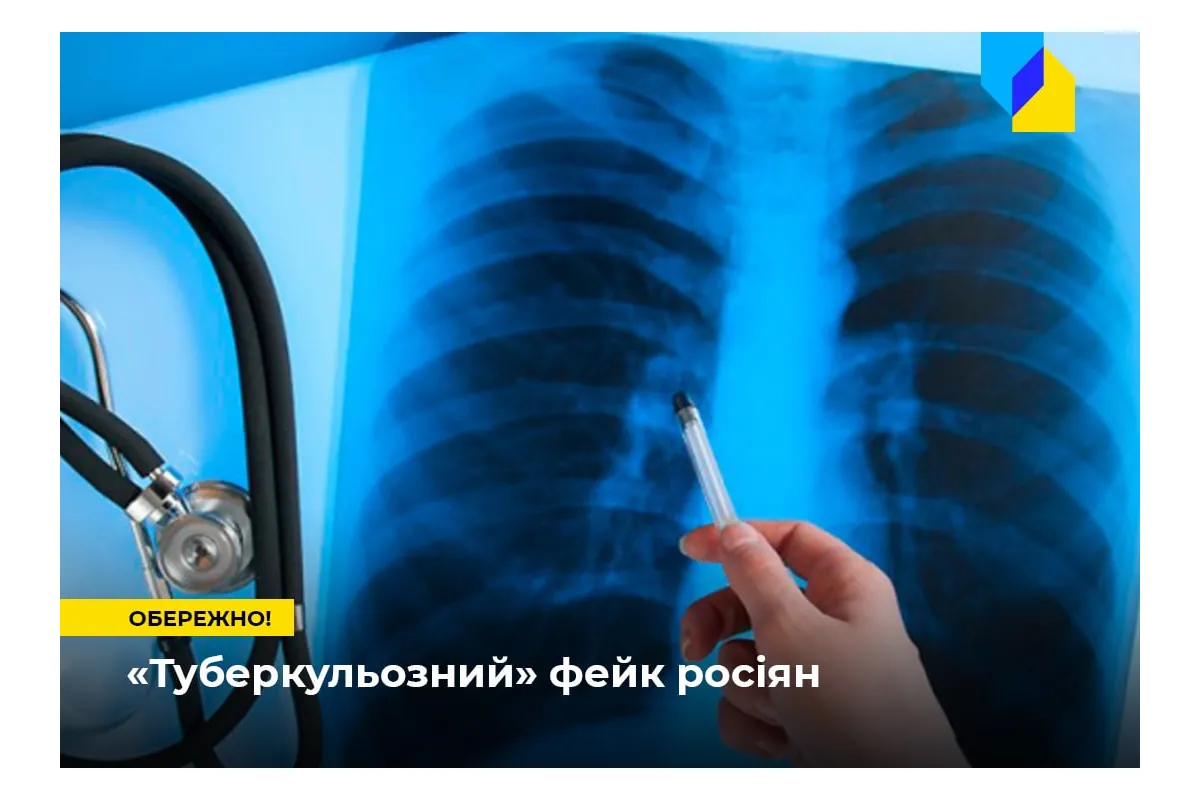 Російське вторгнення в Україну : Обережно, росіяни поширюють фейк про «епідемію туберкульозу в ЗСУ»