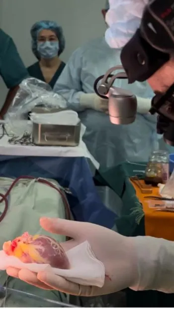​В Україні вперше виконали трансплантацію серця 6-річній дівчинці