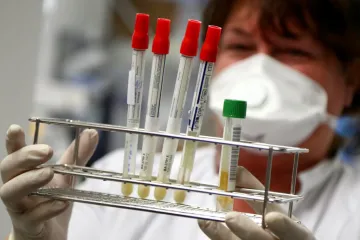 ​Ще 89 мешканців Дніпропетровщини заразилися коронавірусом