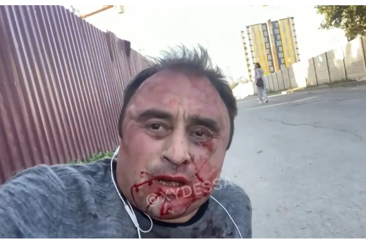 В Одессе избили соучредителя ресторана «Яхта» Сергея Кривенко