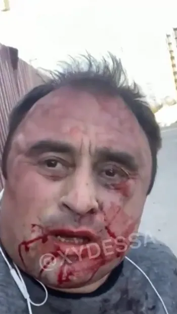 ​В Одессе избили соучредителя ресторана «Яхта» Сергея Кривенко