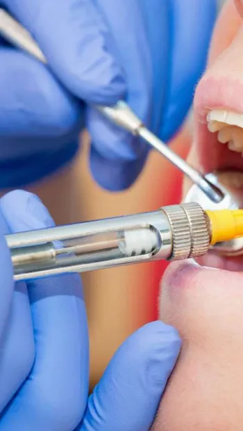 ​Сучасні анестетики в стоматології