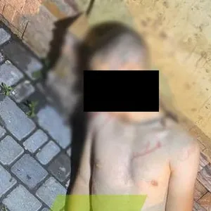 ​В Одессе мужчина получил выстрел в голову после попытки украсть бампер (фото 18+)