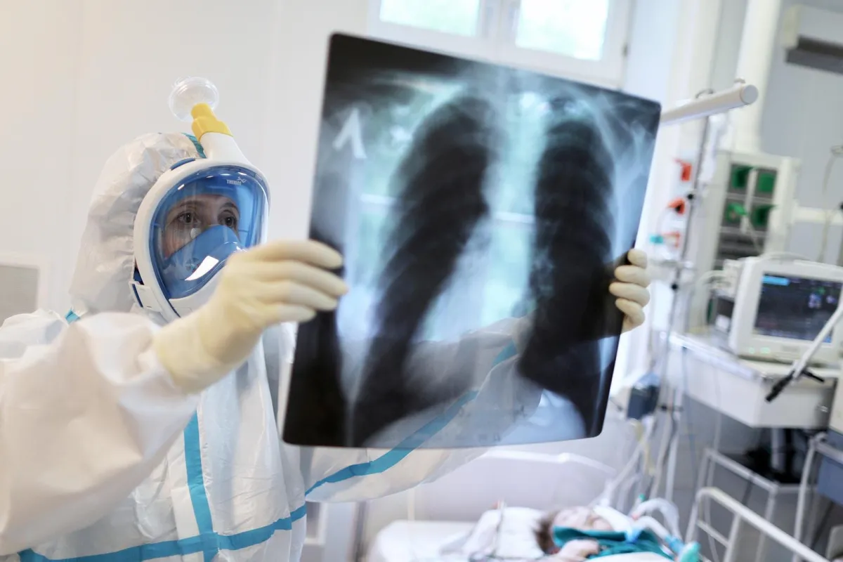 Інформаційне агентство : Пандемія COVID-19 викликала зростання смертності від туберкульозу