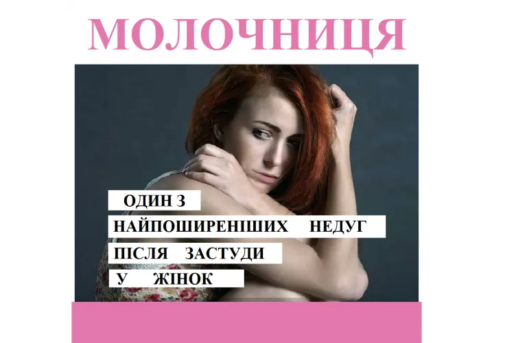 Репродуктолог Київ: Молочниця - один з найпоширеніших недуг після застуди 