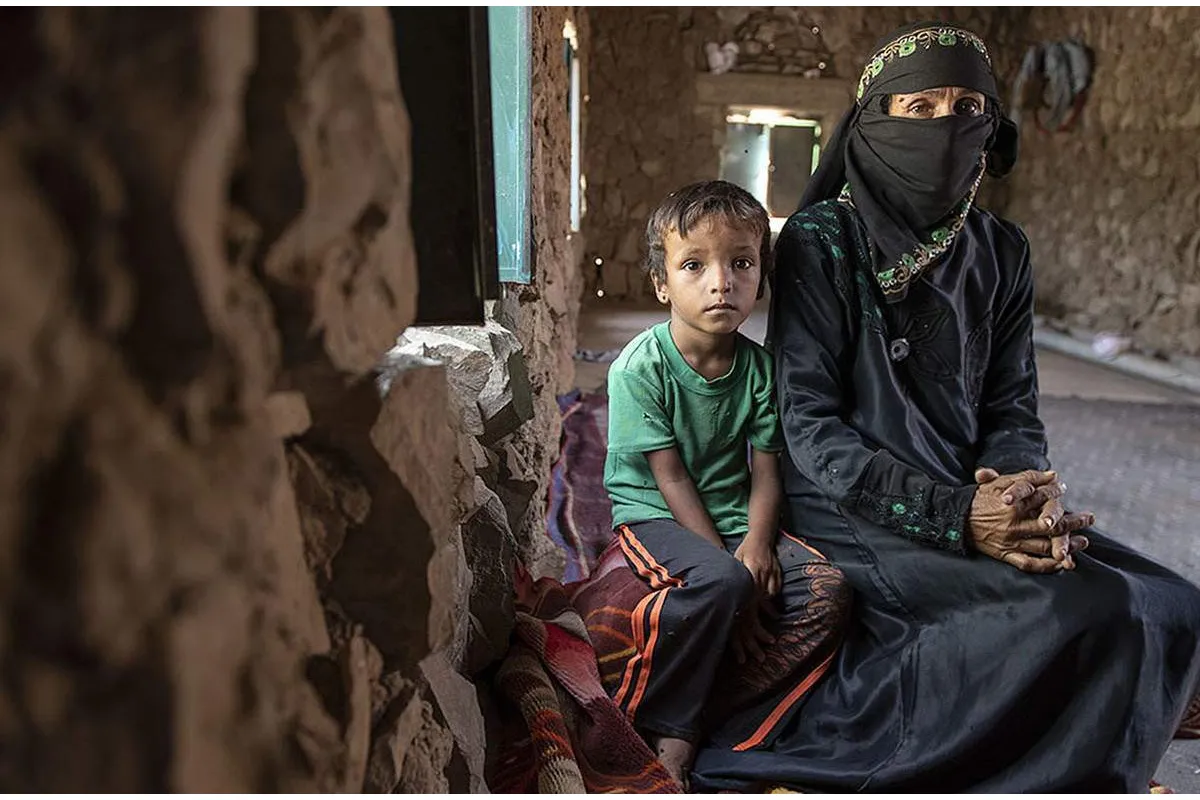 Інформаційне агентство : ЮНІСЕФ: з початку війни в Ємені вбито або покалічено 10 тисяч дітей