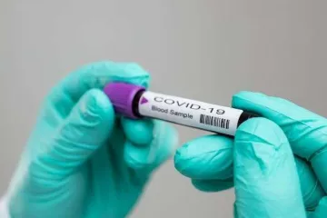​У Запоріжжі виявлено 4 людей з коронавірусом
