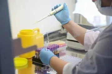 ​Україна виготовлятиме власні високоточні ПЛР-тести на коронавірус