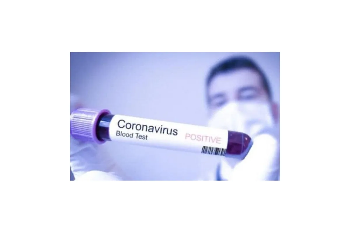 Зупинити COVID-19: вчені та лікарі заявляють про можливу ефективну методику призупинення поширення вірусу (ВІДЕО)