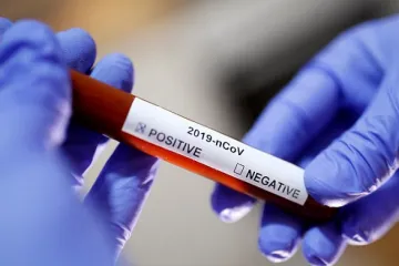 ​В Україну надійдуть швидкі тести на виявлення коронавірусу