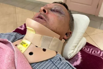 ​У Чорноморську група чоловіків напала на військового та зламала йому шию