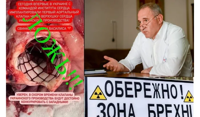 All shrouded in lies? Is that how the Ukrainian cardiac surgery really looks like?