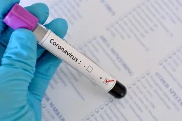 ​Іспанські органи охорони здоров’я виявили неякісну партію тестів на діагностування коронавірусу