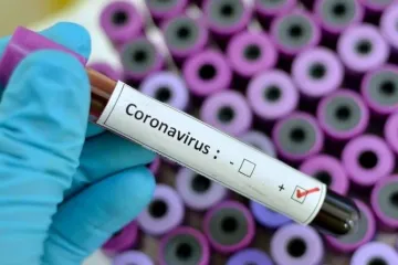 ​  			За минувшие сутки в Италии и США зафиксированы по 5,5 тыс. новых случаев коронавируса. Инфографика		
