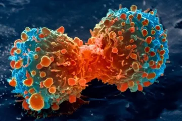 ​  			В США будут лечить рак с помощью клеток, зараженных вирусом иммунодефицита		