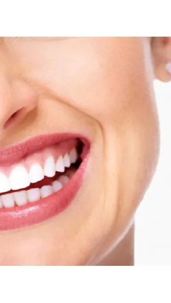 ​Коррекция десневой улыбки ботулиническим токсином